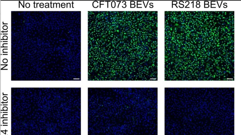 image of fluorescence microscopy that compares cells with and without treatment