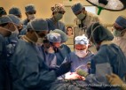 A surgical team operates on a face transplant patient.