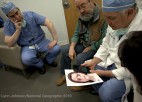 A group of people observes a photo of a face transplant patient.