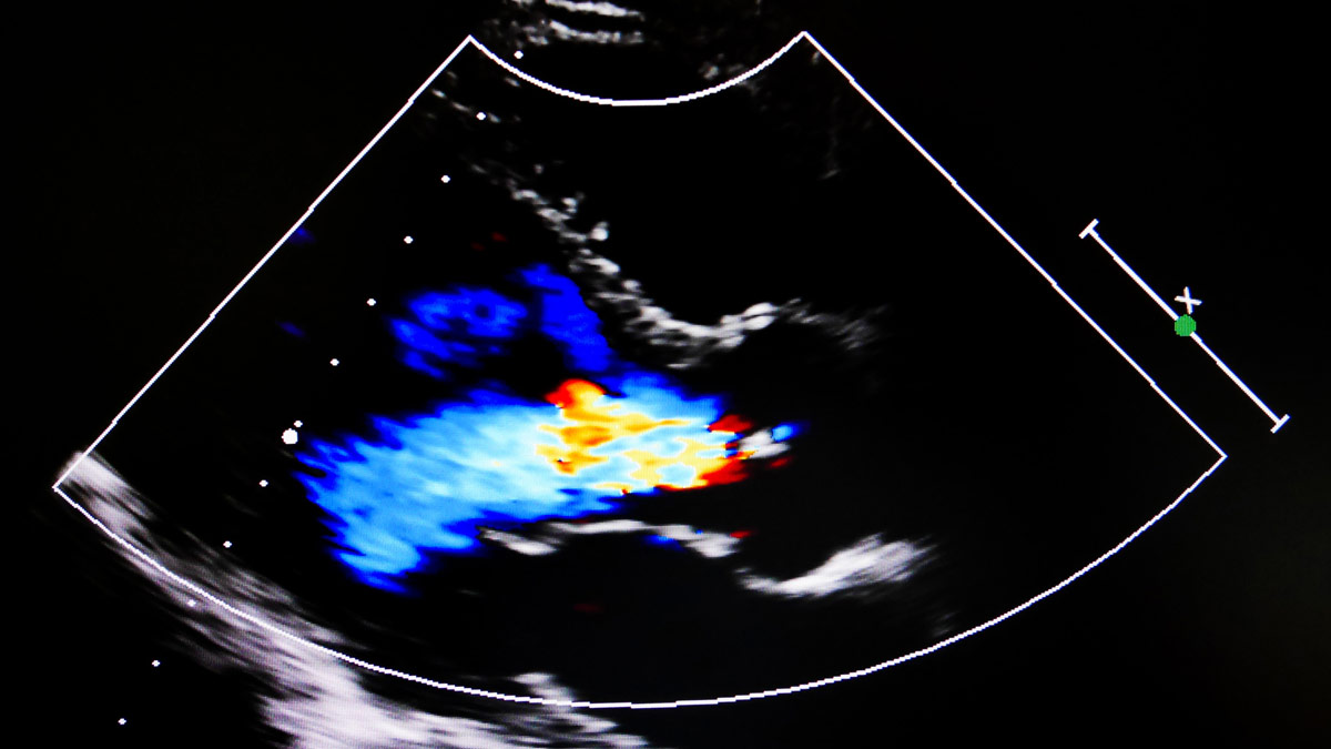 Colorful echocardiogram screen.